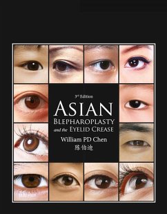 Asian Blepharoplasty and the Eyelid Crease E-Book (eBook, ePUB) - Chen, William P.; Chen, William P.