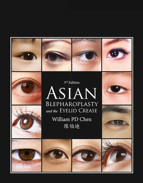 Asian Blepharoplasty and the Eyelid Crease E-Book (eBook, ePUB) Asian Blepharoplasty and the Eyelid Crease E-Book (eBook, ePUB)