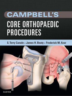 Campbell's Core Orthopaedic Procedures E-Book (eBook, ePUB) - Canale, S. Terry; Beaty, James H.; Azar, Frederick M