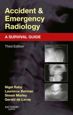 Accident and Emergency Radiology: A Survival Guide (eBook, ePUB) - Raby, Nigel; Berman, Laurence; Morley, Simon; Lacey, Gerald de