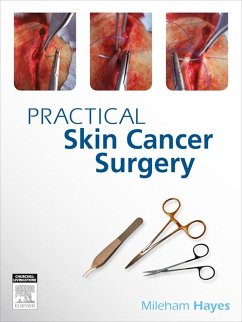 Practical Skin Cancer Surgery (eBook, ePUB) - Hayes, Mileham