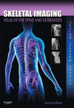 Skeletal Imaging (eBook, ePUB) - Taylor, John A. M.; Hughes, Tudor H.; Resnick, Donald L.