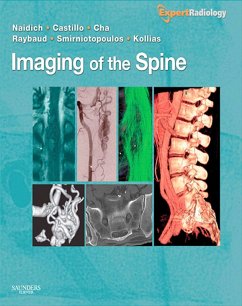 Cover Imaging of the Spine E-Book (eBook, ePUB)