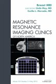 Breast MRI, An Issue of Magnetic Resonance Imaging Clinics (eBook, ePUB)