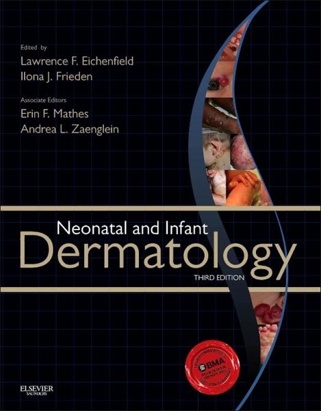 Neonatal and Infant Dermatology E-Book (eBook, ePUB) Neonatal and Infant Dermatology E-Book (eBook, ePUB)