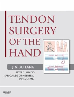 Cover Tendon Surgery of the Hand E-Book (eBook, ePUB)