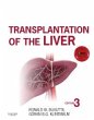 Transplantation of the Liver (eBook,... - Bild 1