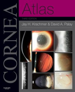 Cornea Atlas E-Book (eBook, ePUB) - Krachmer MD, Jay H.; Palay MD, David A