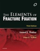 Elements of Fracture Fixation - E-book (eBook, ePUB)