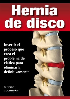 Hernia de disco - cerrar sin cirugía (eBook, ePUB) - Guglielmotti, Gustavo