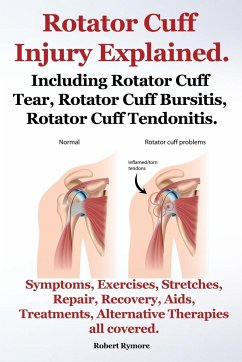 Rotator Cuff Injury Explained. Including Rotator Cuff Tear, Rotator Cuff Bursitis, Rotator Cuff Tendonitis. Symptoms, Exercises, Stretches, Repair, Re - Rymore, Robert