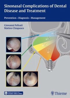 Sinonasal Complications of Dental Disease and Treatment - Felisati, Giovanni;Chiapasco, Matteo