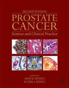Cover Prostate Cancer (eBook, ePUB)