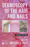 Dermoscopy of the Hair and Nails (eBook, PDF)