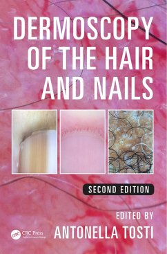 Dermoscopy of the Hair and Nails (eBook, PDF)