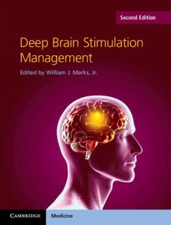 Deep Brain Stimulation Management (eBook, PDF)