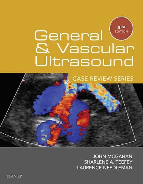 General and Vascular Ultrasound: Case Review Series E-Book (eBook, ePUB)
