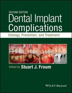 Dental Implant Complications (eBook, ePUB)