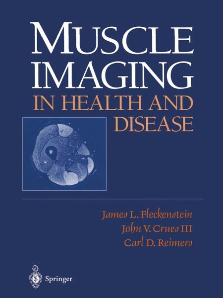 Muscle Imaging in Health and Disease (eBook, PDF) Muscle Imaging in Health and Disease (eBook, PDF)