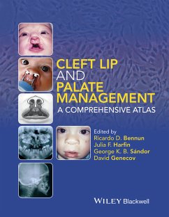 Cleft Lip and Palate Management (eBook, ePUB) - Sándor, George K. B.; Genecov, David