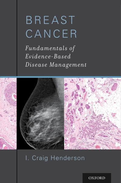 Breast Cancer (eBook, ePUB)