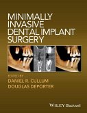 Minimally Invasive Dental Implant Surgery (eBook, ePUB)