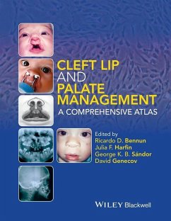 Cleft Lip and Palate Management (eBook, PDF) - Sándor, George K. B.; Genecov, David
