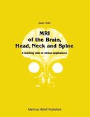 MRI of the Brain, Head, Neck and Spine (eBook, PDF)