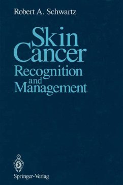 Skin Cancer (eBook, PDF) - Schwartz, Robert A.