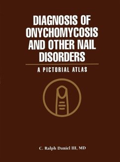 Diagnosis of Onychomycosis and Other Nail Disorders (eBook, PDF) - Daniel, C. Ralph III