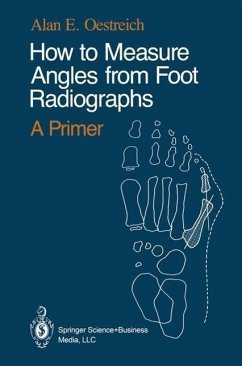 How to Measure Angles from Foot Radiographs (eBook, PDF) - Oestreich, Alan E.