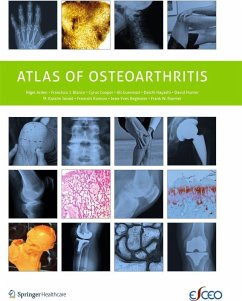 Atlas of Osteoarthritis (eBook, PDF) - Arden, Nigel; Reginster, Jean-Yves; Blanco, Francisco; Cooper, C.; Guermazi, Ali; Hayashi, Daichi; Hunter, David; Javaid, M. Kassim; Rannou, Francois; Roemer, Frank