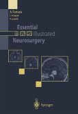 Essential Illustrated Neurosurgery (eBook, PDF)
