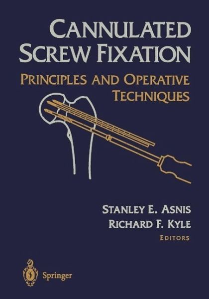 Cannulated Screw Fixation (eBook, PDF)