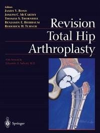 Revision Total Hip Arthroplasty (eBook, PDF)