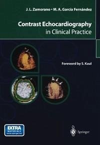Contrast Echocardiography in Clinical Practice (eBook, PDF) - Zamorano, Jose L.; García Fernández, Miguel A.