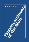 Pseudocarcinoma of the Skin (eBook, PDF)