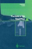 Fractures of the Tibial Pilon (eBook, PDF)