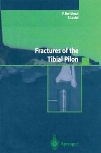 Fractures of the Tibial Pilon (eBook, PDF) - Bartolozzi, P.; Lavini, F.