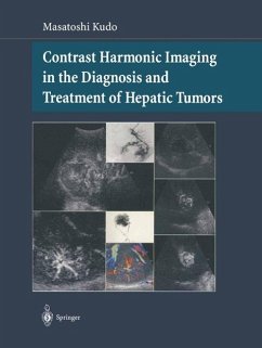 Cover Contrast Harmonic Imaging in the Diagnosis and Treatment of Hepatic Tumors (eBook, PDF)