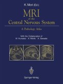 MRI of the Central Nervous System (eBook, PDF)