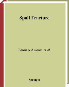 Spall Fracture (eBook, PDF) - Antoun, Tarabay; Seaman, Lynn; Curran, Donald R; Kanel, Gennady I.; Razorenov, Sergey V.; Utkin, Alexander V.