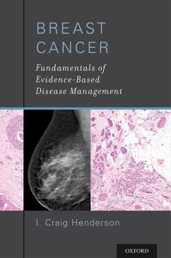 Breast Cancer (eBook, PDF) - Henderson, I. Craig MD