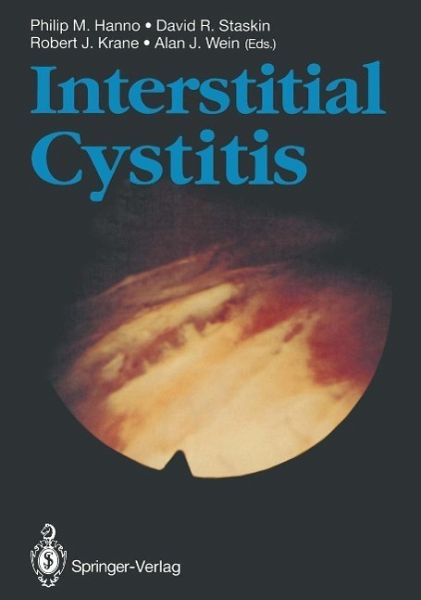Interstitial Cystitis (eBook, PDF)