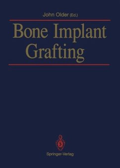 Bone Implant Grafting (eBook, PDF)