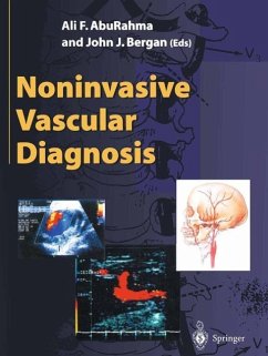 Noninvasive Vascular Diagnosis (eBook, PDF)