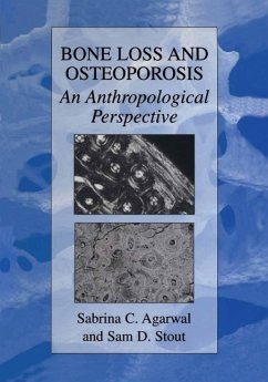 Bone Loss and Osteoporosis (eBook, PDF)