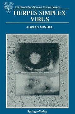 Herpes Simplex Virus (eBook, PDF) - Mindel, Adrian