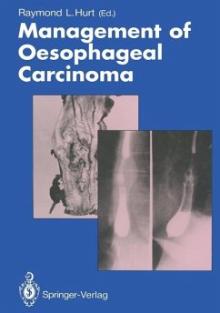 Management of Oesophageal Carcinoma (eBook, PDF) Cover Management of Oesophageal Carcinoma (eBook, PDF)
