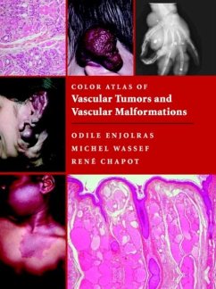 Color Atlas of Vascular Tumors and Vascular Malformations (eBook, PDF) - Enjolras, Odile
